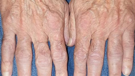  《 rheumatoid arthritis 》: 關於愛情、命運，和一群在台北街頭流浪的年輕人！